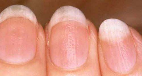 Что означают разные цвета ногтей. О чем может рассказать цвет ногтей