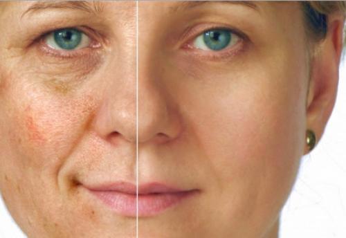 Как сделать лицо моложе. Самые эффективные способы омоложения лица в домашних условиях