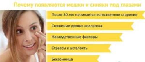 Мешки под глазами причины. Почему образуются мешки у здоровых женщин