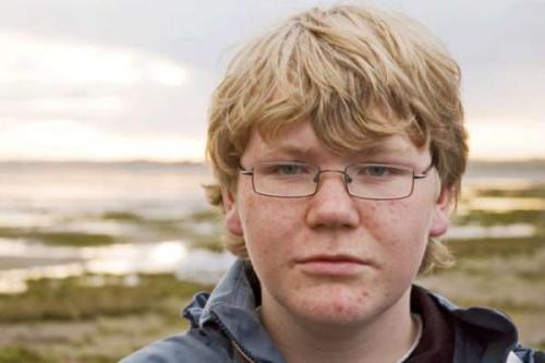 Маски от прыщей в домашних условиях для подростков. Маска от подростковых прыщей в домашних условиях