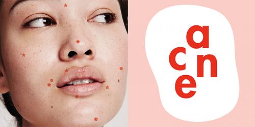 Маски для лица в домашних условиях против черных точек и прыщей. Особенности лечения прыщей в домашних условиях 01 Маски для лица в домашних условиях против черных точек и прыщей. Особенности лечения прыщей в домашних условиях 01