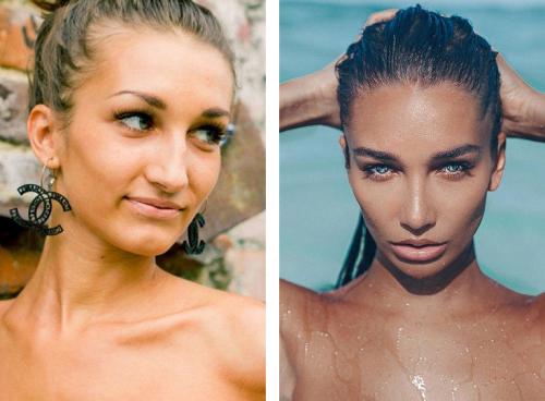 Звезды инстаграмма до пластики. 12 российских звезд Instagram до и после пластики! Не узнать! 08