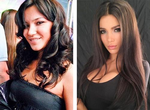 Звезды инстаграмма до пластики. 12 российских звезд Instagram до и после пластики! Не узнать! 11