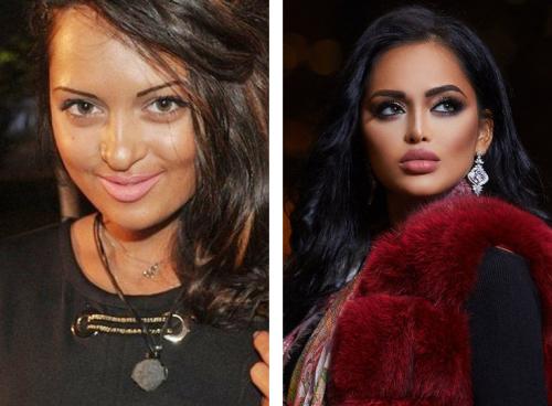 Звезды инстаграмма до пластики. 12 российских звезд Instagram до и после пластики! Не узнать! 10