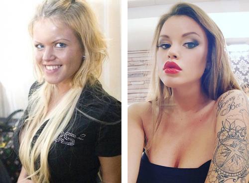Звезды инстаграмма до пластики. 12 российских звезд Instagram до и после пластики! Не узнать! 04