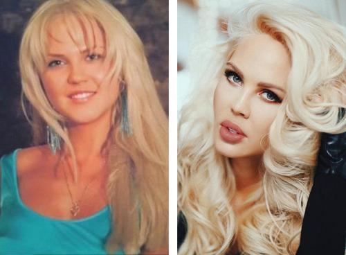 Звезды инстаграмма до пластики. 12 российских звезд Instagram до и после пластики! Не узнать! 07
