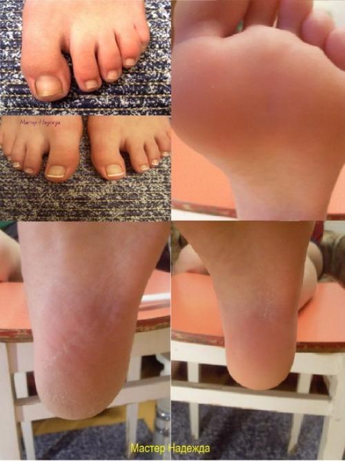 Как делать педикюр гель-лаком. Как сделать педикюр гель-лаком