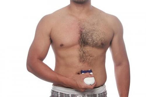 Удаление волос в интимных местах в домашних условиях. Депиляция интимной зоны 02