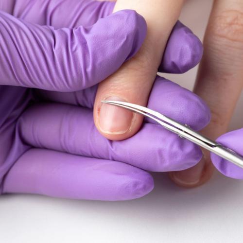 Почему цветной гель-лак отслаивается от базы. Почему гель-лак не держится на ногтях?