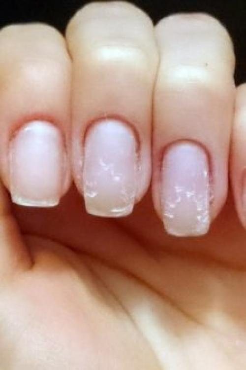 Почему гель-лак слезает пленкой. Почему отслаивается гель-лак от ногтей: причины и особенности