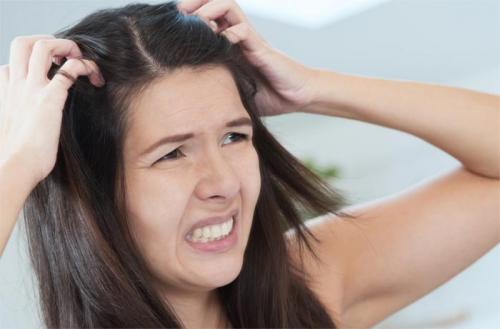 Маска против перхоти в домашних условиях. Домашние рецепты масок против перхоти