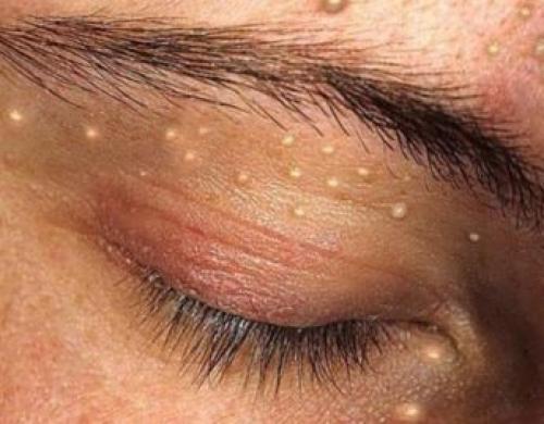 Быстрое отращивание бровей и ресниц: 5 простых способов 05 Быстрое отращивание бровей и ресниц: 5 простых способов 05