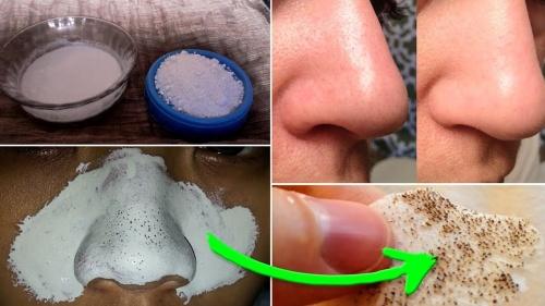 Маска от черных точек в домашних условиях без желатина. Маски от черных точек в домашних условиях