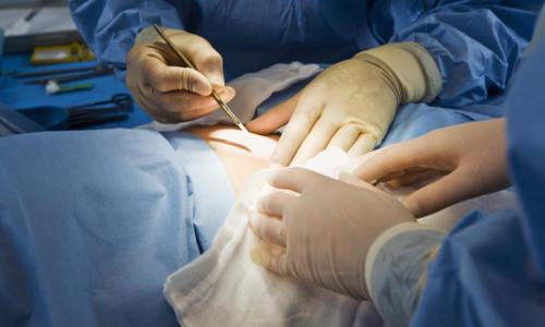 Как сделать кожу упругой и подтянутой. Причины потери упругости кожи 02 Как сделать кожу упругой и подтянутой. Причины потери упругости кожи 02