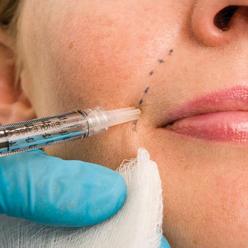 Все лицо в уколах. Инъекционные процедуры в косметологии 13