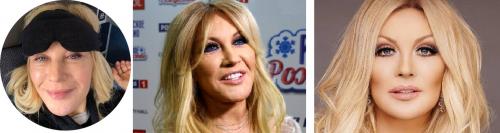 Как менялась внешность Таисии Повалий до и после пластики. Изменила все лицо: стало известно о пластических операциях Таисии Повалий 02 Как менялась внешность Таисии Повалий до и после пластики. Изменила все лицо: стало известно о пластических операциях Таисии Повалий 02