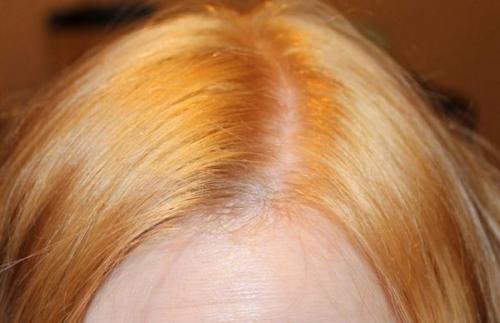 Какие средства помогают убрать желтизну в волосах