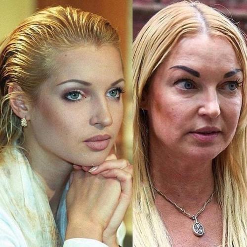 Можно ли делать шторку, если волосы тонкие или редкие. Ошибки, которые совершают женщины с редкими волосами