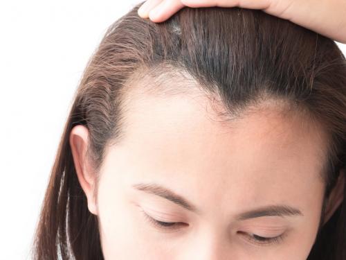 Челка на Большой лоб: что это такое и как с этим жить 07