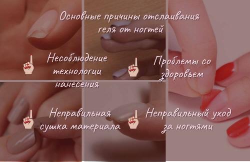 Откуда берутся отслойки и как с ними бороться. Причины отслоения сетчатки глаза 02