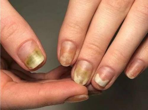 Почему ногти под гель-лаком мягкие. Болезненность ногтей после геля-лака причины и выход.