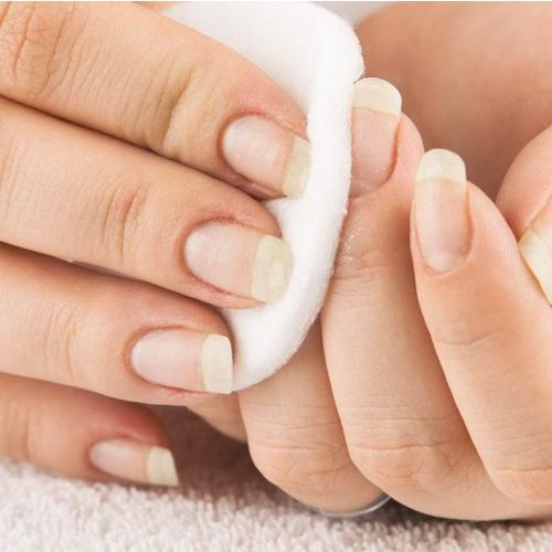 Гель-лак отошел от ногтя, что делать. Причина первая: ногти не готовы