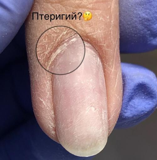 Гель-лак и толщина покрытия. Все шаги идеального маникюра 06 Гель-лак и толщина покрытия. Все шаги идеального маникюра 06