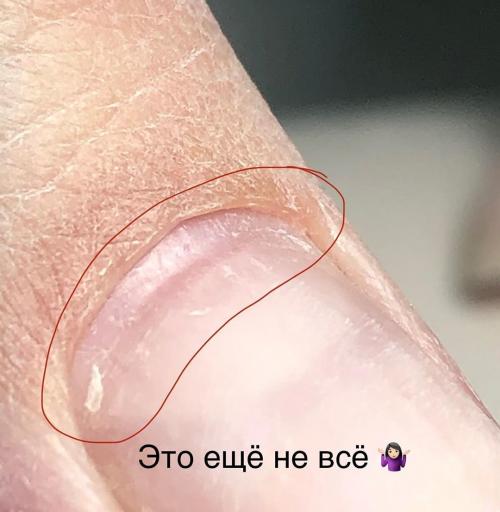 Гель-лак и толщина покрытия. Все шаги идеального маникюра 10 Гель-лак и толщина покрытия. Все шаги идеального маникюра 10