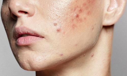 Секреты красоты: эффективные методы ухода за кожей лица 01