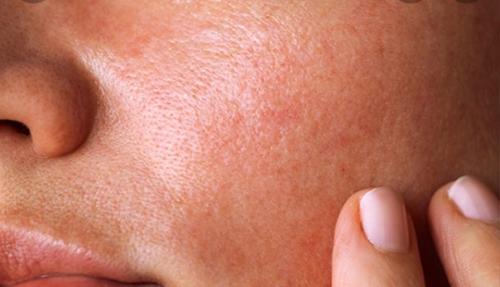 Помимо красивых причёсок, макияжа, одежды, надо понимать, что всё это не законченный этап - без этапа хорошего ухода за вашей кожей. 03