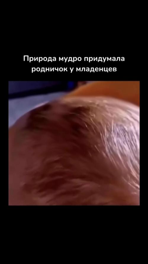 Родничок у малыша - один из самых удивительных элементов раннего развития человека. 01 Родничок у малыша - один из самых удивительных элементов раннего развития человека. 01
