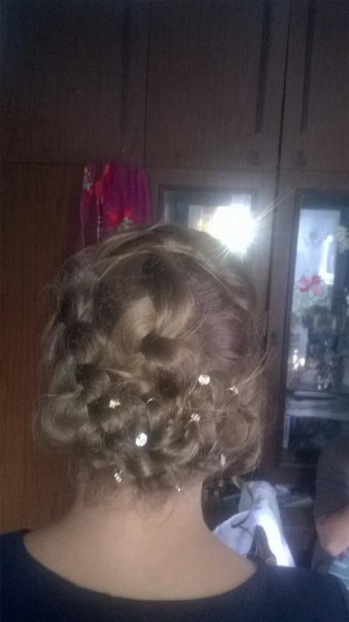 Выпадение ресниц. Причины и лечение. 05 Выпадение ресниц. Причины и лечение. 05