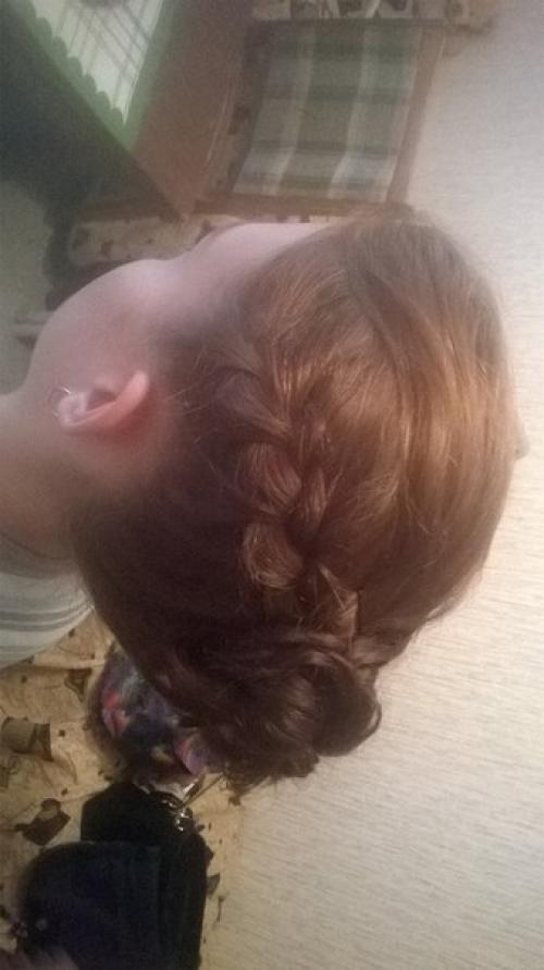 Выпадение ресниц. Причины и лечение. 01 Выпадение ресниц. Причины и лечение. 01