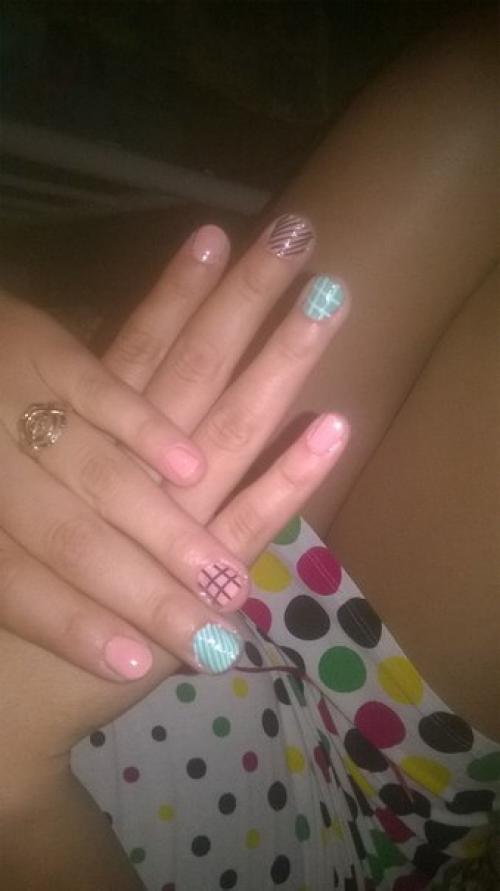 Выпадение ресниц. Причины и лечение. 04 Выпадение ресниц. Причины и лечение. 04