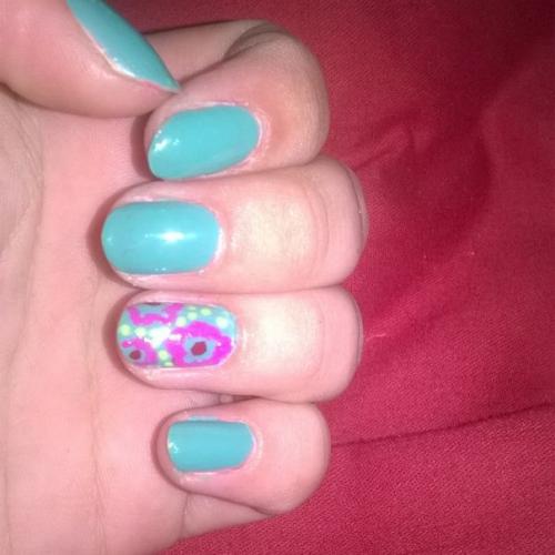 Выпадение ресниц. Причины и лечение. 07 Выпадение ресниц. Причины и лечение. 07