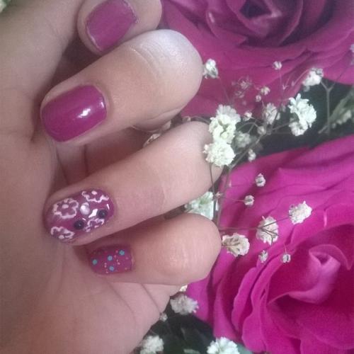 Выпадение ресниц. Причины и лечение. 06 Выпадение ресниц. Причины и лечение. 06