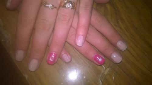 Выпадение ресниц. Причины и лечение. 02 Выпадение ресниц. Причины и лечение. 02