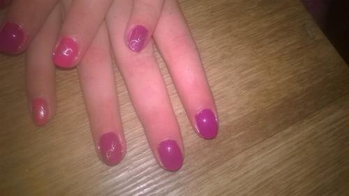 Выпадение ресниц. Причины и лечение. 03 Выпадение ресниц. Причины и лечение. 03