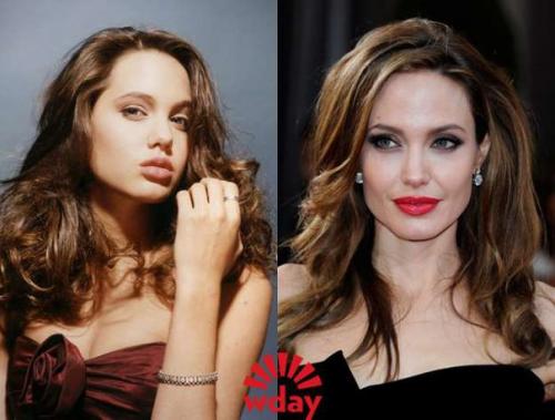 Звёзды до и после пластических операций. 03 Звёзды до и после пластических операций. 03