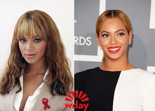 Звёзды до и после пластических операций. 09 Звёзды до и после пластических операций. 09