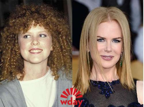 Звёзды до и после пластических операций. 02 Звёзды до и после пластических операций. 02