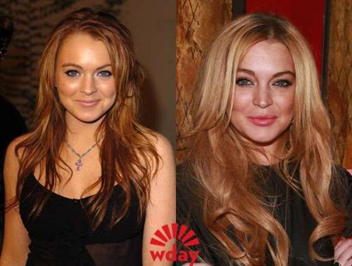 Звёзды до и после пластических операций. 01 Звёзды до и после пластических операций. 01