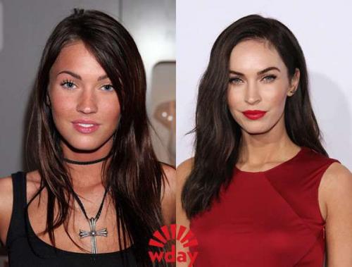 Звёзды до и после пластических операций. 05 Звёзды до и после пластических операций. 05