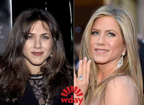 Звёзды до и после пластических операций. 07 Звёзды до и после пластических операций. 07