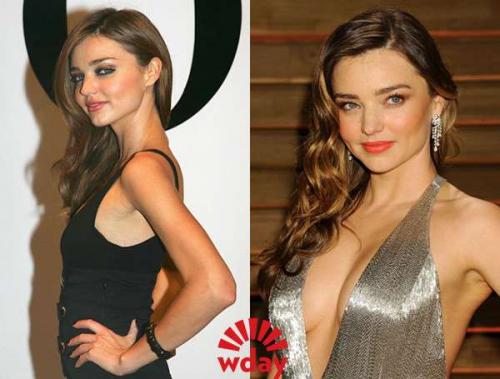 Звёзды до и после пластических операций. 06 Звёзды до и после пластических операций. 06