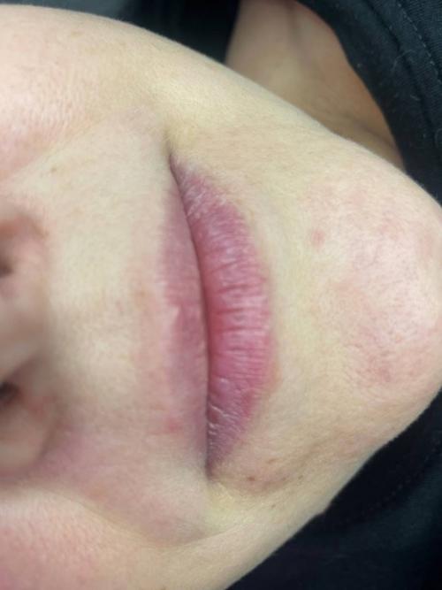 Боюсь не будет результата …. 07 Боюсь не будет результата …. 07