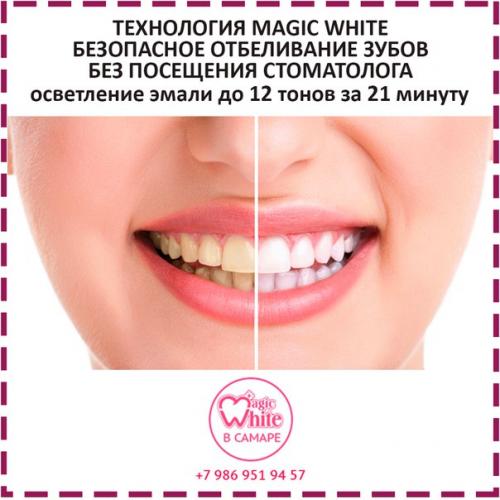 Magic waits. Мэджик Вайт отбеливание. Magic White картинки. Мэджик Вайт отбеливание визитка.