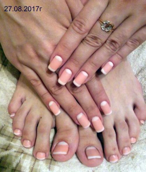 Как убрать Ушки на бедрах? 05 Как убрать Ушки на бедрах? 05