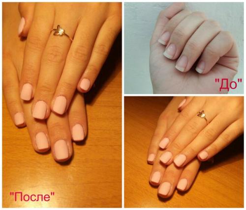 Как убрать Ушки на бедрах? 03 Как убрать Ушки на бедрах? 03