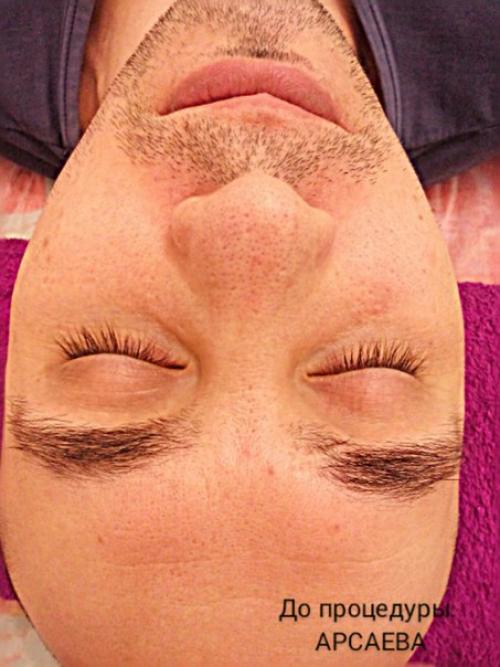 Требуются модели. Депиляция: 03 Требуются модели. Депиляция: 03